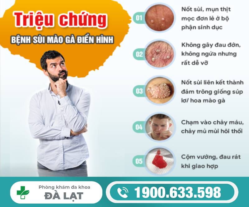 Hình ảnh minh họa